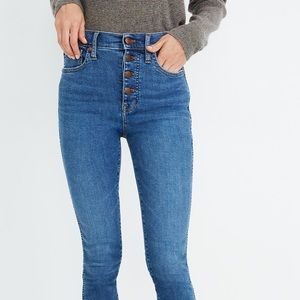 Madewell Button-Fly Skinny Jeans